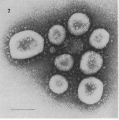 mckintosh-virus